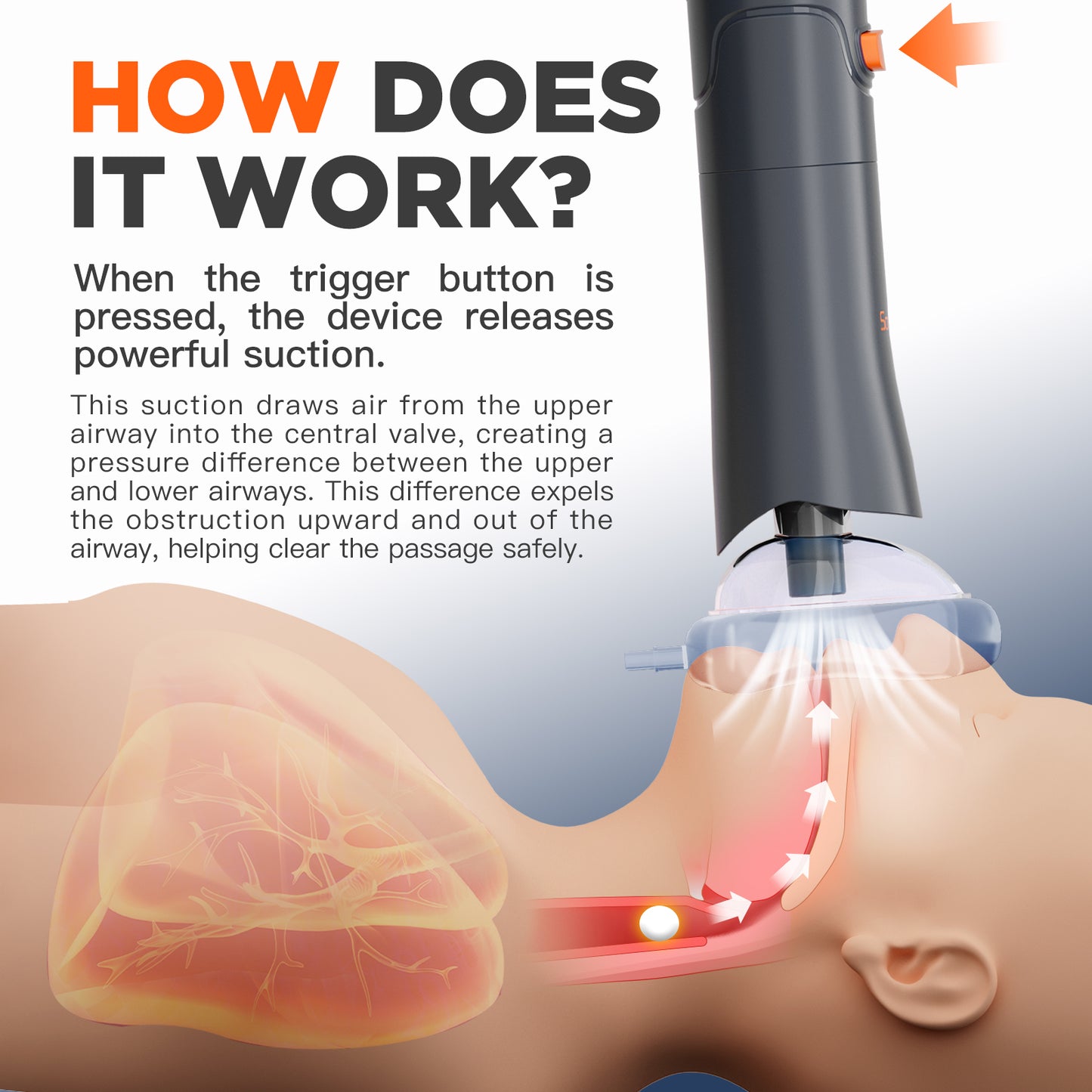 Sonmol Automatic Anti Choking Device with 3 Masks, Smaller & Lightler